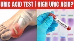 'Uric acid test | uric acid test procedure | uric acid test normal range'