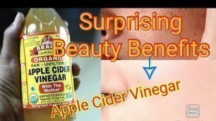 Surprising Beauty Benefits of Apple Cider Vinegar - NaturalWay TV