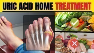 'Uric acid home treatment |  uric acid foods to avoid'