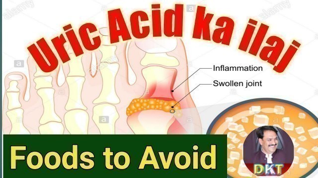 'uric acid treatment | foods to avoid | uric acid ka ilaj | ilyas adil'