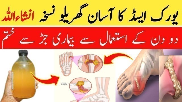 'What is Uric Acid In Urdu|Uric Acid Ka Ilaj||Uric acid ka desi ilaj||Uric acid home remedy'