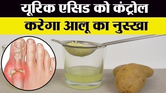 'Uric Acid Control करेगा Potato का नुस्खा, जड़ से खत्म होगी बीमारी | Boldsky'