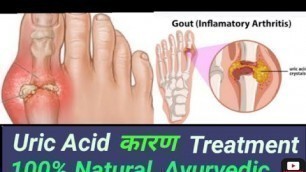 'Uric acid, causes,Treatment,Natural, Ayurvedic,Unani,Foods,100%,इलाज, जड़ से कम करें, घरेलू, यूनानी'