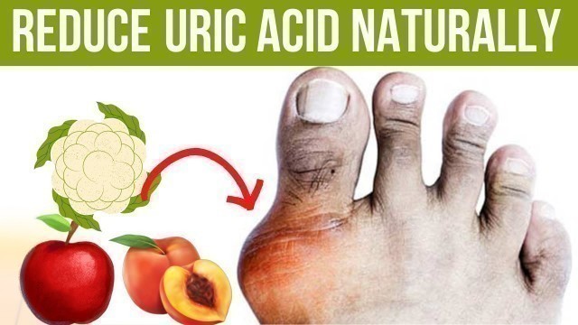 'Reduce uric Acid naturally | Uric Acid foods to avoid and eat'