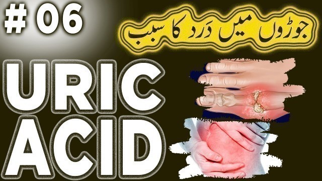 'URIC ACID TREATMENT IN URDU-HINDI | URIC ACID FOODS TO AVOID | ARSHAD HOMEOPATHIC CLINIC'