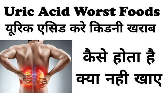 'Uric Acid Gout Diet in Hindi | यूरिक एसिड फूड्स लिस्ट | Uric Acid Me Kya Nahi Khana Chahiye | GOUT |'