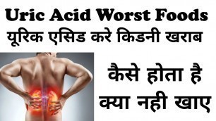 'Uric Acid Gout Diet in Hindi | यूरिक एसिड फूड्स लिस्ट | Uric Acid Me Kya Nahi Khana Chahiye | GOUT |'