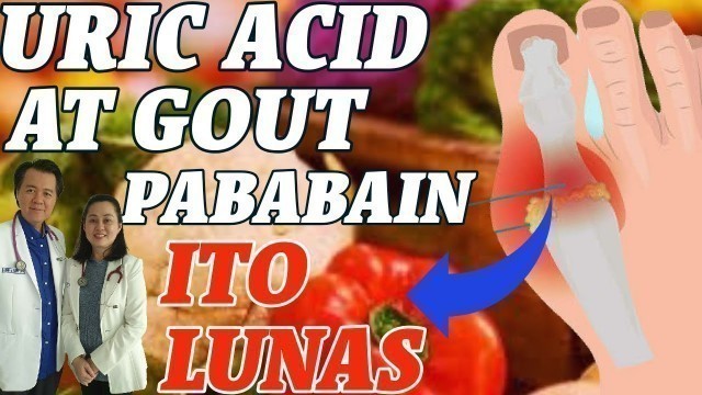 'Uric Acid at Gout : Pababain, Ito Lunas - Payo ni Doc Liza Ong'