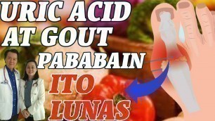 'Uric Acid at Gout : Pababain, Ito Lunas - Payo ni Doc Liza Ong'