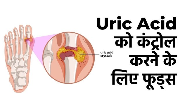 'Gout Diet: यूरिक एसिड को कंट्रोल करने के लिए फूड्स | Uric Acid Best Foods'