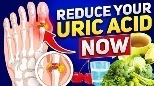 'TOP 10 Foods That Lower Your Uric Acid Levels'