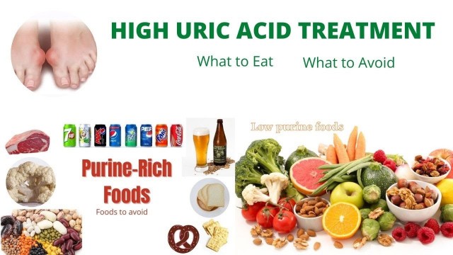 'High Uric Acid Treatment: What food to eat and What to avoid / How to get rid of Gout - Natural Cure'