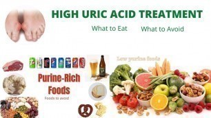 'High Uric Acid Treatment: What food to eat and What to avoid / How to get rid of Gout - Natural Cure'