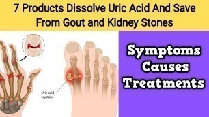 'Foods To Lower Uric Acid Level Naturally - 7 Products Dissolve Uric Acid'