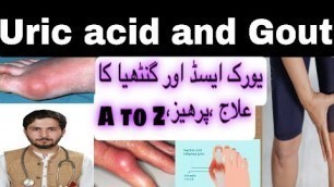 'Uric acid and Gout treatment,diet plan,prevention and medicine(Dr.Akbari) یورک ایسڈ اور گنٹھیا'