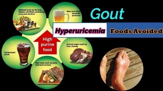 'Uric acid avoids food list. What Foods Should You Avoid with High uric acid or Gout? hyperuricemia.'