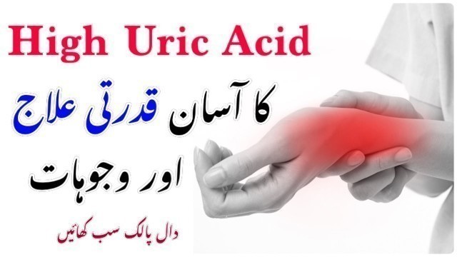 'Treatment and Causes of High Uric Acid | Diet for uric acid | Gout Treatment | Dr Amina'