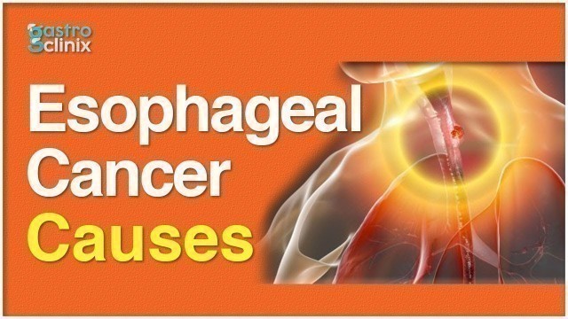 'Why does Esophageal (Food pipe) cancer Occour? | Gastroclinix'