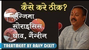 'Rajiv Dixit- TREATMENT OF GANGRINE, ECZEMA, PSORISIS,'