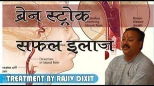 'Rajiv Dixit-TREATMENT OF BRAIN STROKE, ब्रेन स्ट्रोक का इलाज'