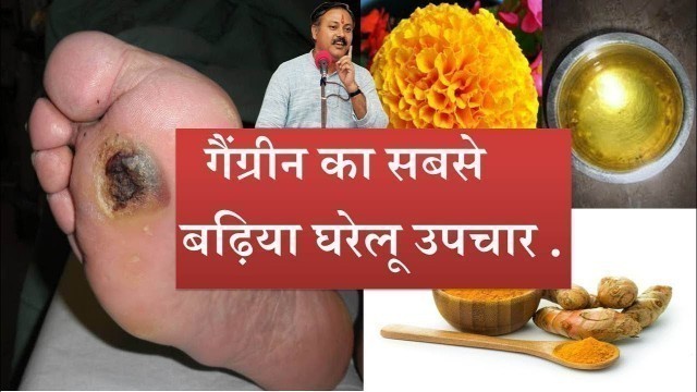 'Rajiv Dixit : How to Cure Gangrene Best ayurvedic home remedies........'