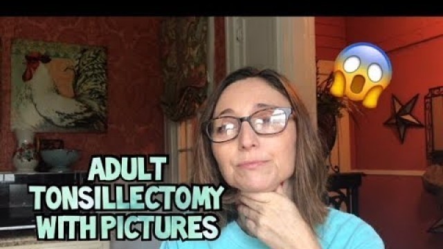 'Adult Tonsillectomy with Tips, Food, and Pictures'