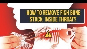 'How to remove stuck fish bone from throat'