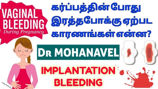 'கர்ப்பகால இரத்தபோக்கு- Bleeding During Pregnancy Causes Treatment-Tamil- Dr MOHANAVEL'