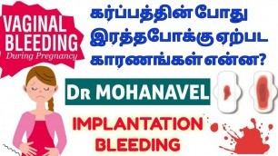 'கர்ப்பகால இரத்தபோக்கு- Bleeding During Pregnancy Causes Treatment-Tamil- Dr MOHANAVEL'