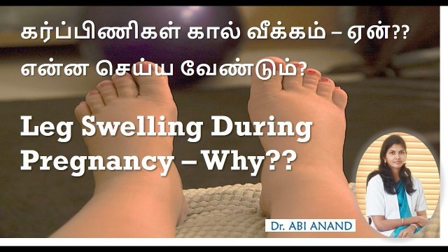 'Leg swelling| Pregnancy tips| Tamil & eng des|என்ன செய்ய வேண்டும்?5 tips u must know!!in description'