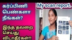 'Anomaly scan in Tamil//Anomaly scan and other scan in Tamil//pregnancy scan details in Tamil//'