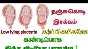 'நஞ்சு கொடி இரக்கம் | Nanju Kodi Irakkam in Tamil |   Placenta Position During Pregnancy.'