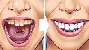 '28 EASY TEETH HACKS THAT WORK MAGIC'